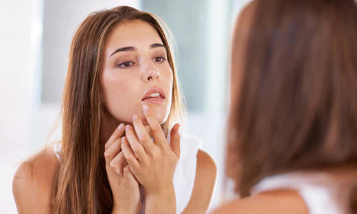 Treating Cystic Acne: 3 Ways to Treat the Stubborn Devil Zits Fast with GreenOpia Naturals