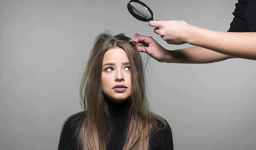 Know Your Hair: Learning Everything about Dandruff with The Minies